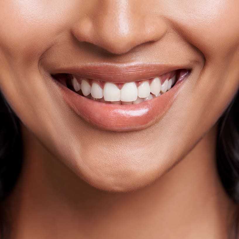 http://Derma%20Beauty%20Clinic%20-%20Gummy%20Smile