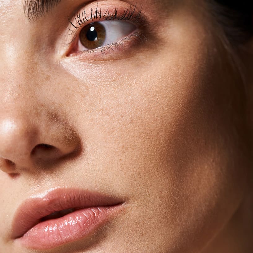 http://Derma%20Beauty%20Clinic%20-%20Sunken%20Cheeks
