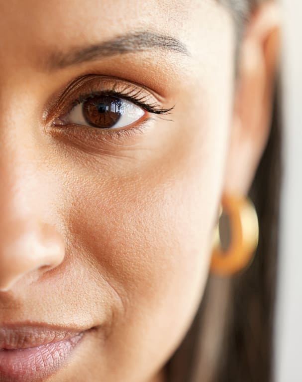 http://Derma%20Beauty%20Clinic%20-%20Sunken%20Eye%20Bags%20Advice